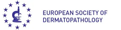 ESDP
